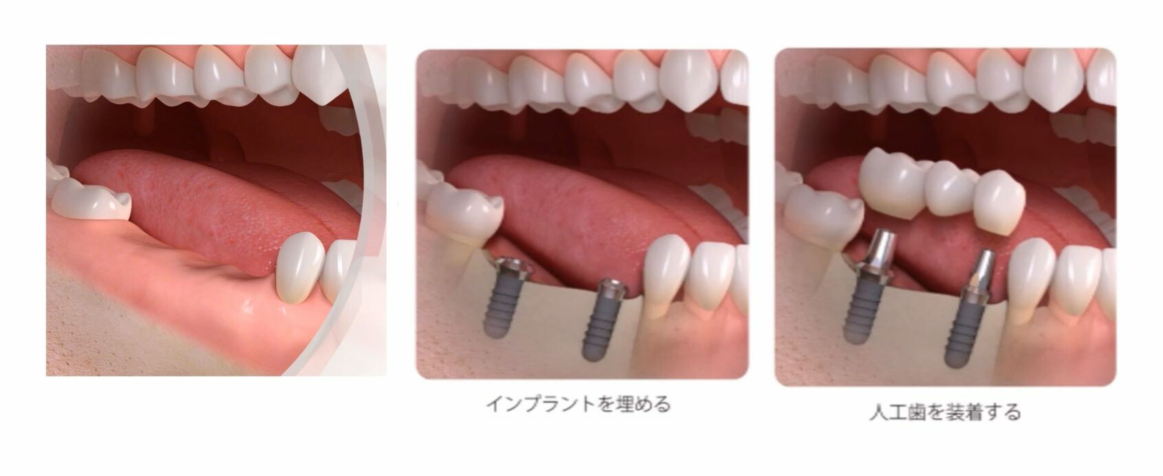 今お使いの入れ歯でこんなお悩みはありませんか？